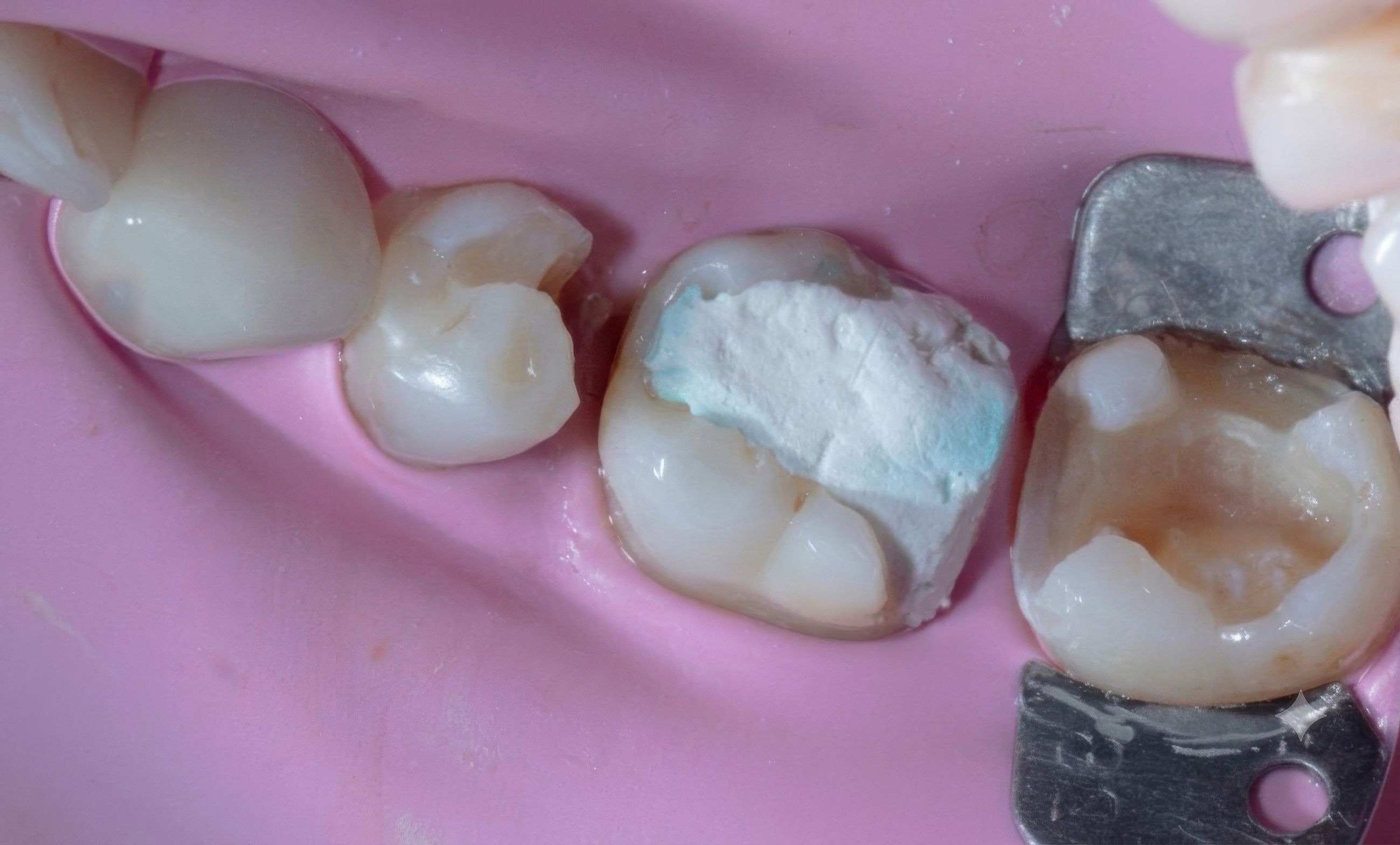 Narvekar-Quadrant Makeover Using Three Different Matrices-061626