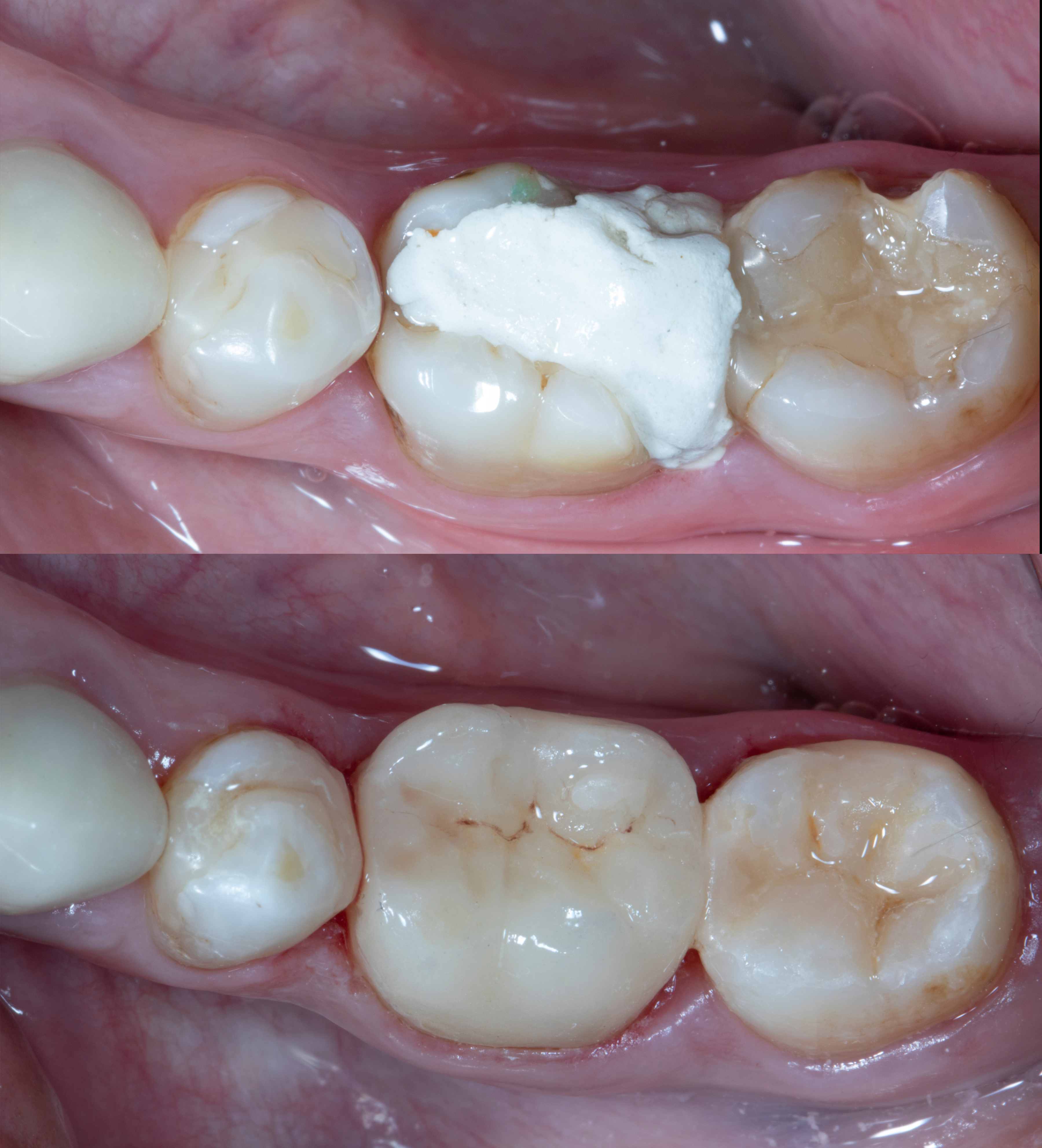 Narvekar-Quadrant Makeover Using Three Different Matrices-061626