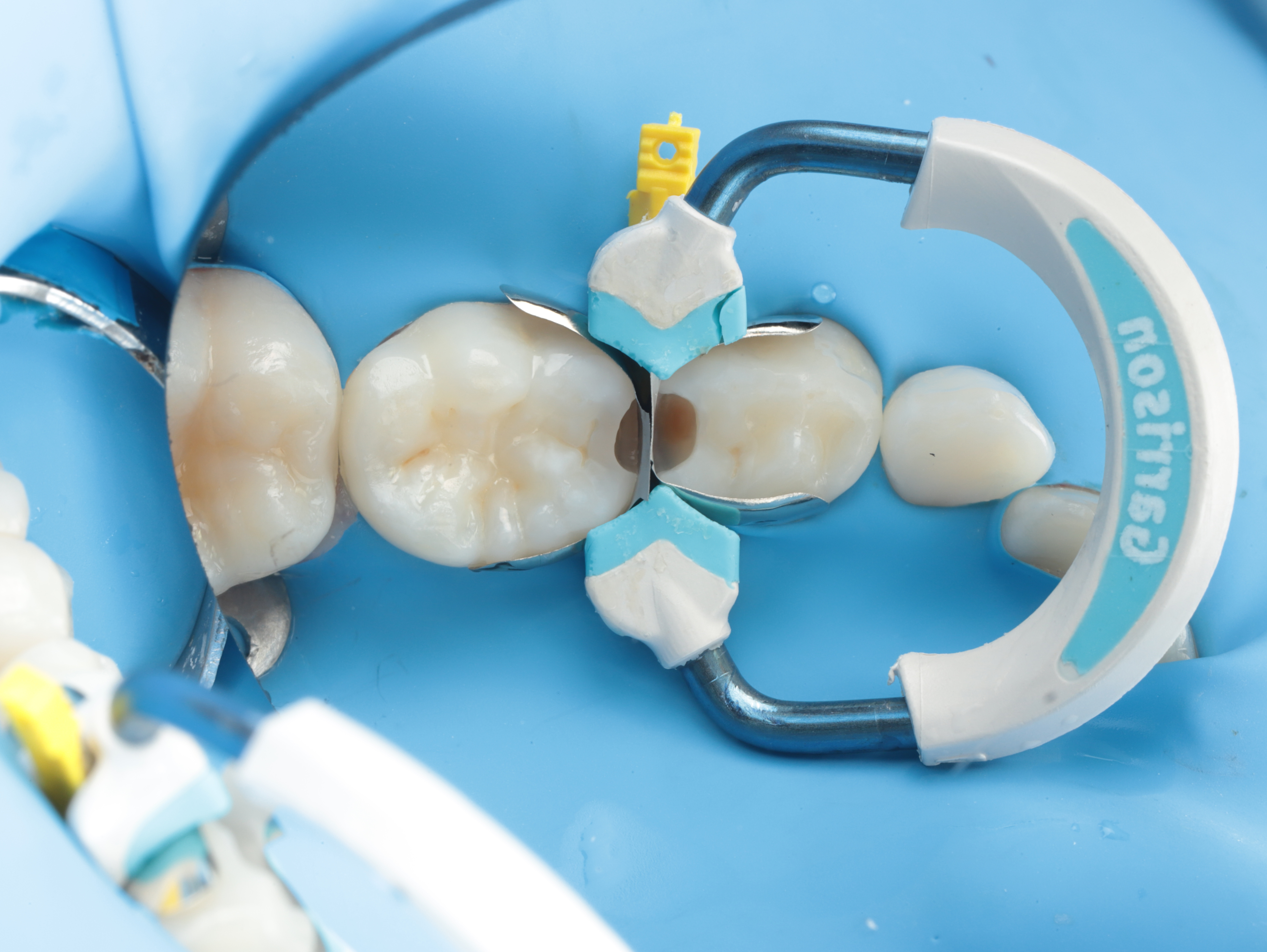 Case Study Image