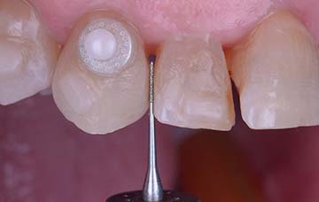 Raso IPR Case Study Image