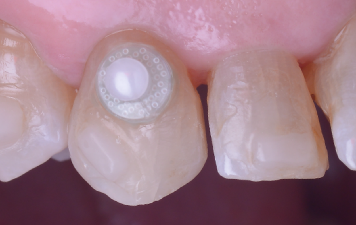Raso IPR Case Study Image