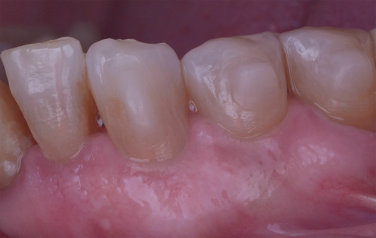 Raso IPR Case Study Image