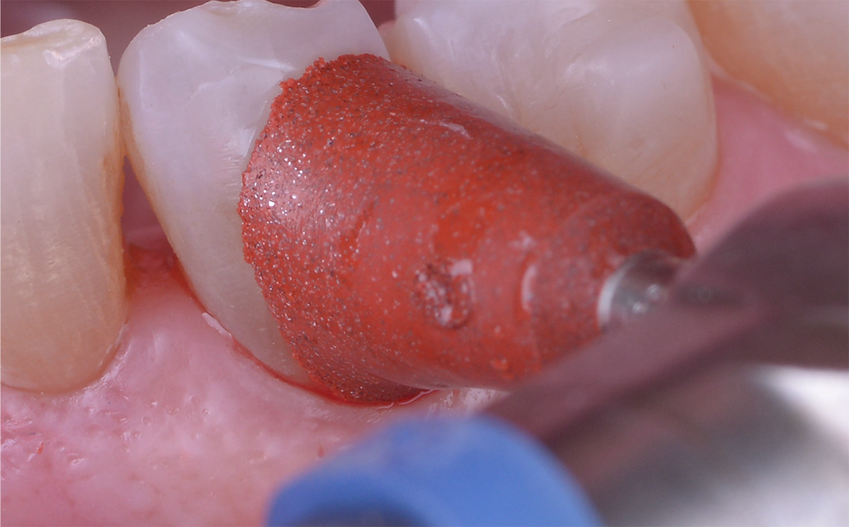 Raso IPR Case Study Image