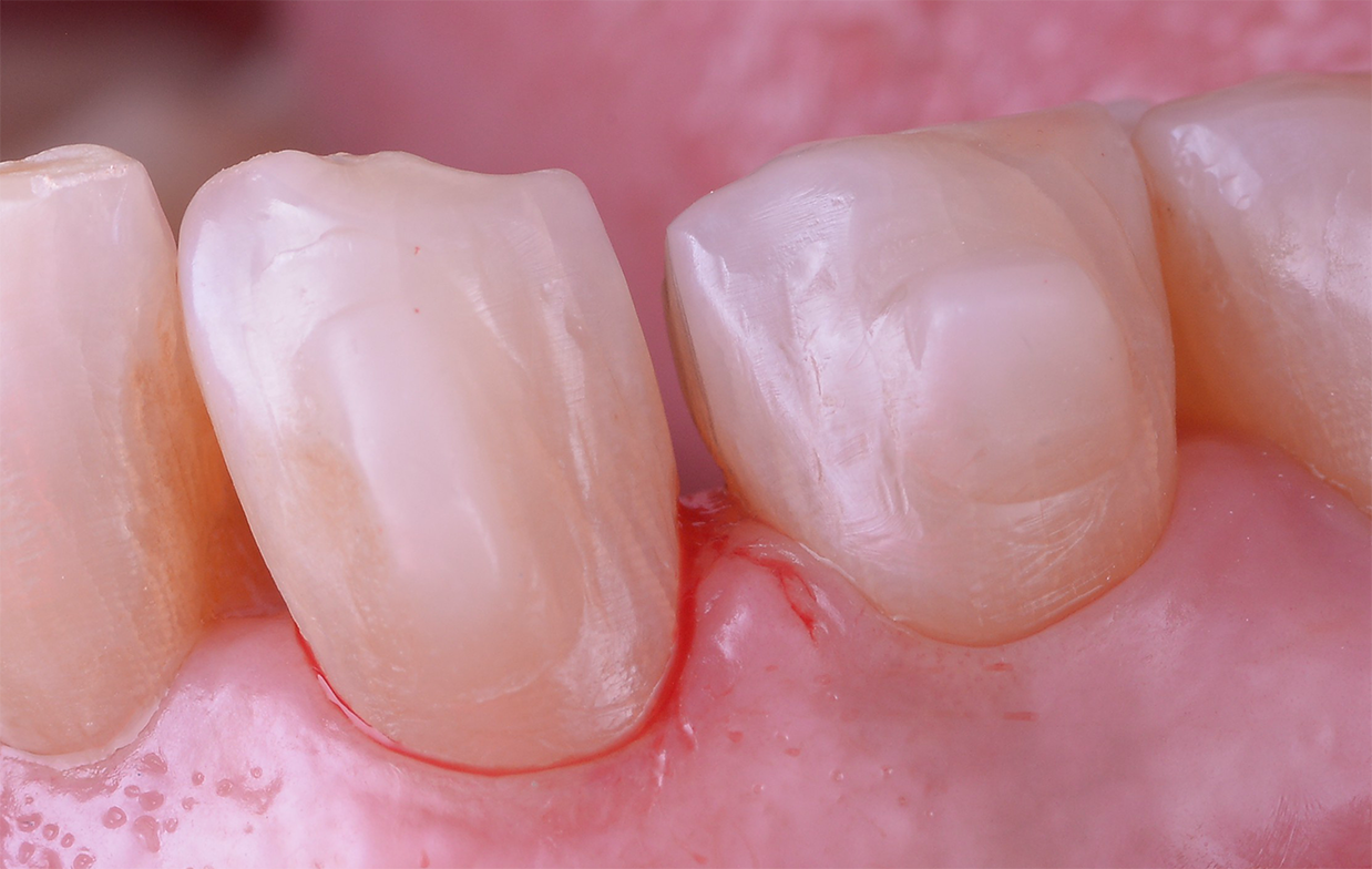Raso IPR Case Study Image