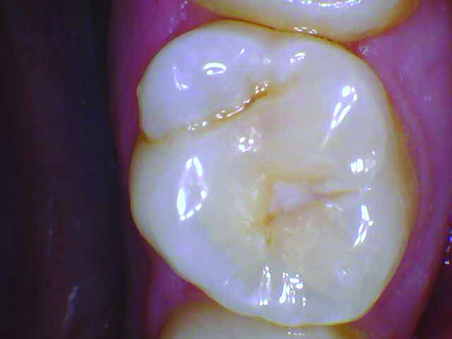 RomeneskoNick_Preop 3_013025 Figure 3