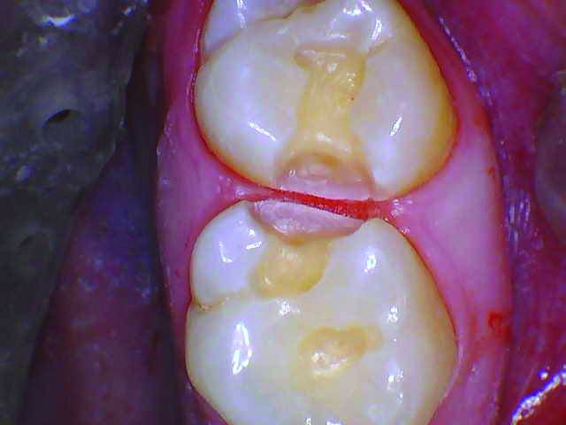 RomeneskoNick_Prepped 2 and 3_013025 Figure 4