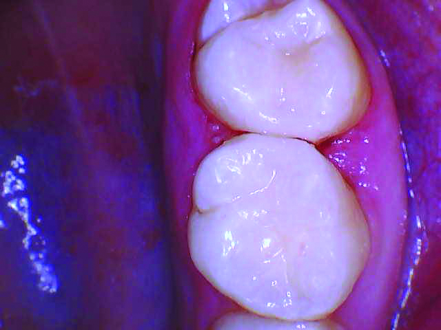 RomeneskoNick_Untrimmed 2 and 3_013025 Figure 7b