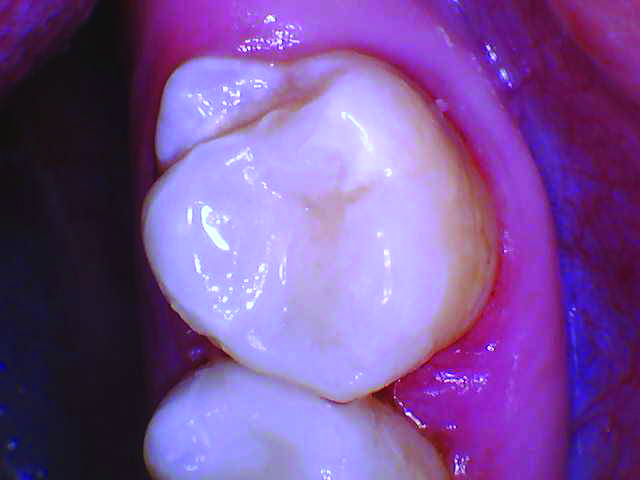 RomeneskoNick_Untrimmed 2_01302 Figure 7a