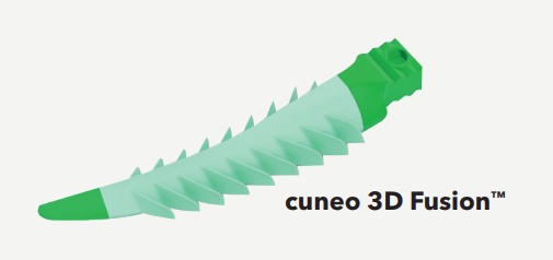 Cuneo 3D Fusion
