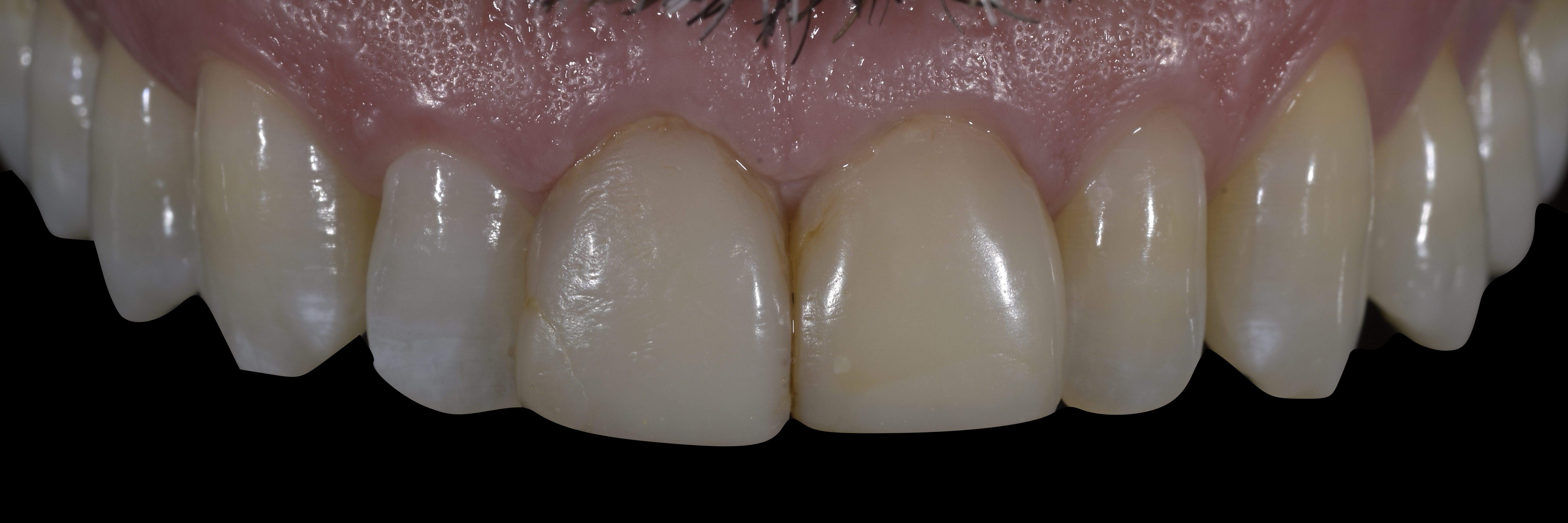 Sommella Using FitStrip Diamond Abrasive Strips images