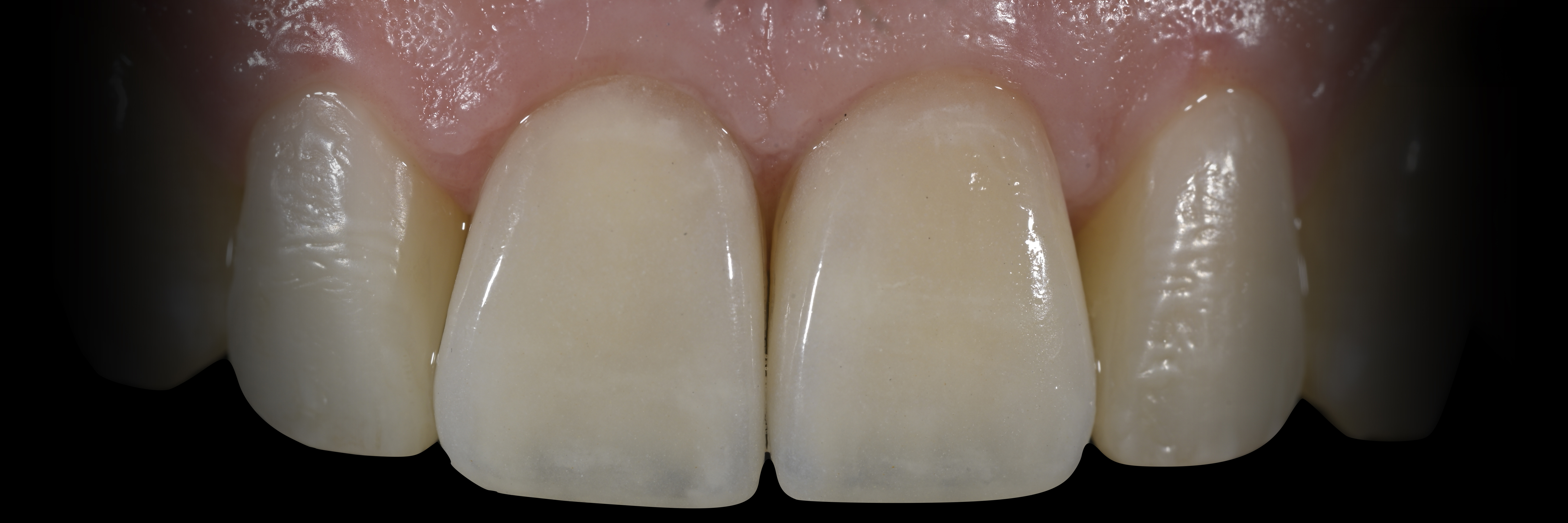 Sommella Using FitStrip Diamond Abrasive Strips images