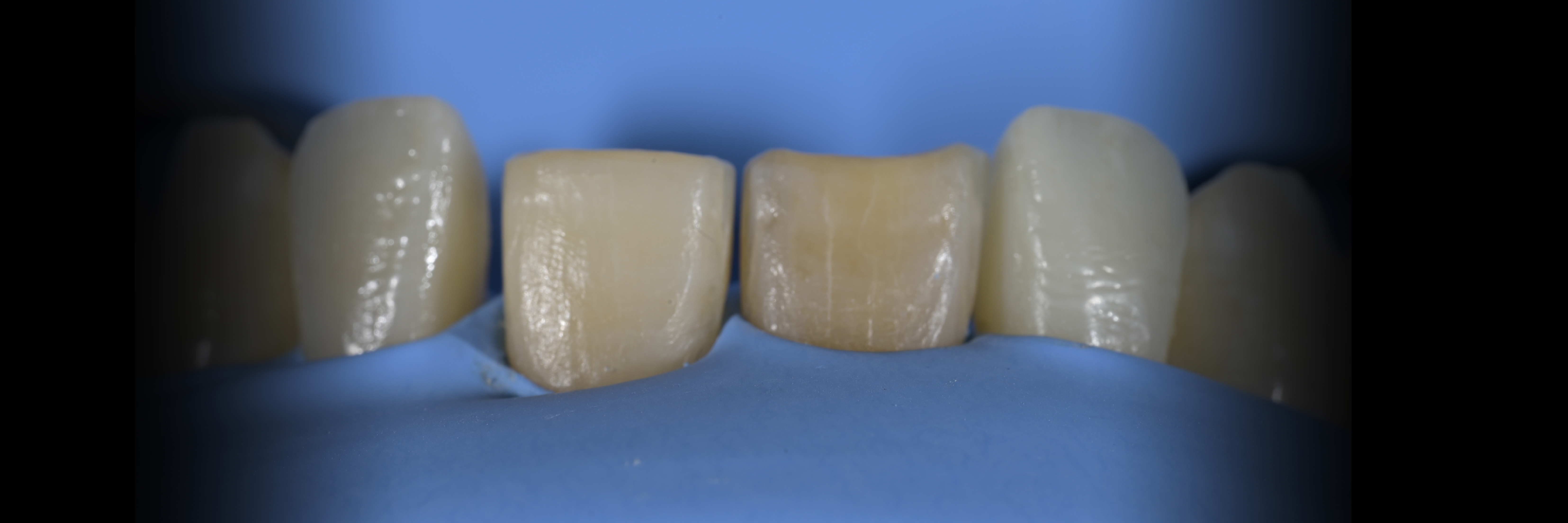 Sommella Using FitStrip Diamond Abrasive Strips images