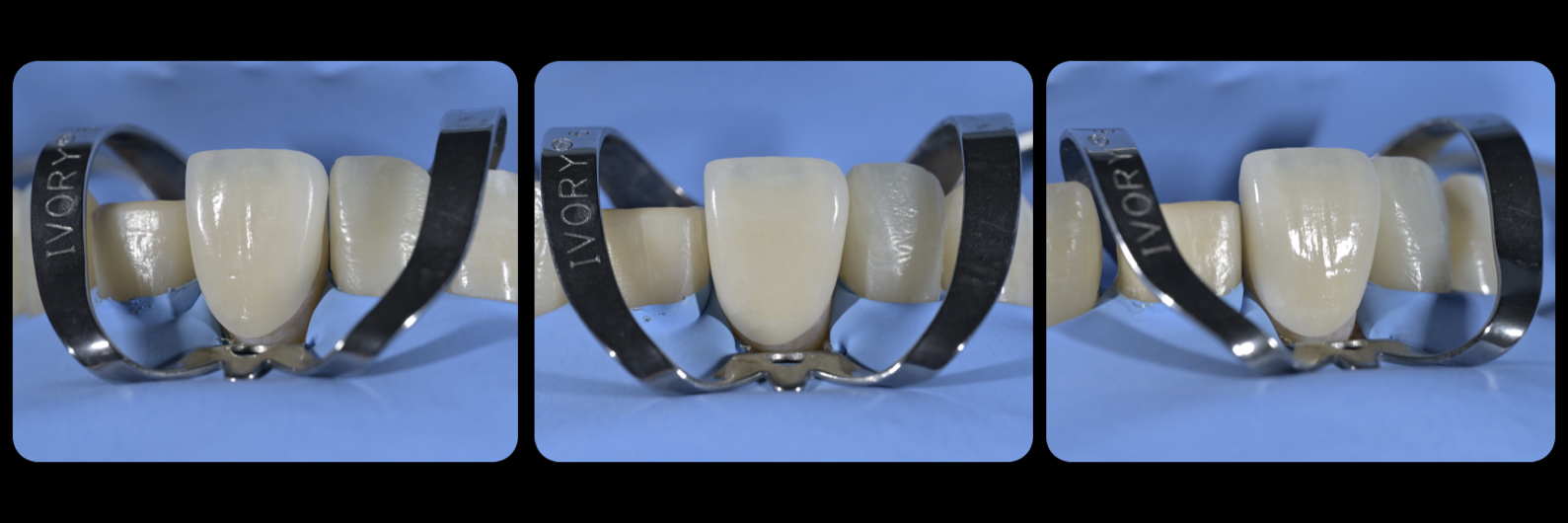 Sommella Using FitStrip Diamond Abrasive Strips images