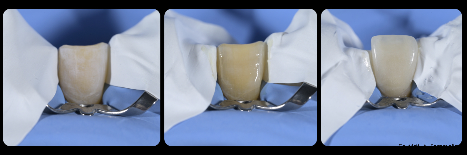 Sommella Using FitStrip Diamond Abrasive Strips images
