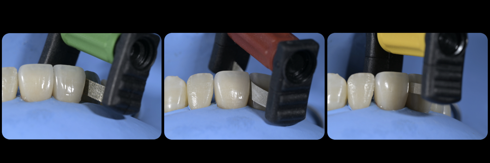 Sommella Using FitStrip Diamond Abrasive Strips images