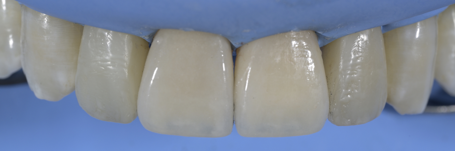 Sommella Using FitStrip Diamond Abrasive Strips images
