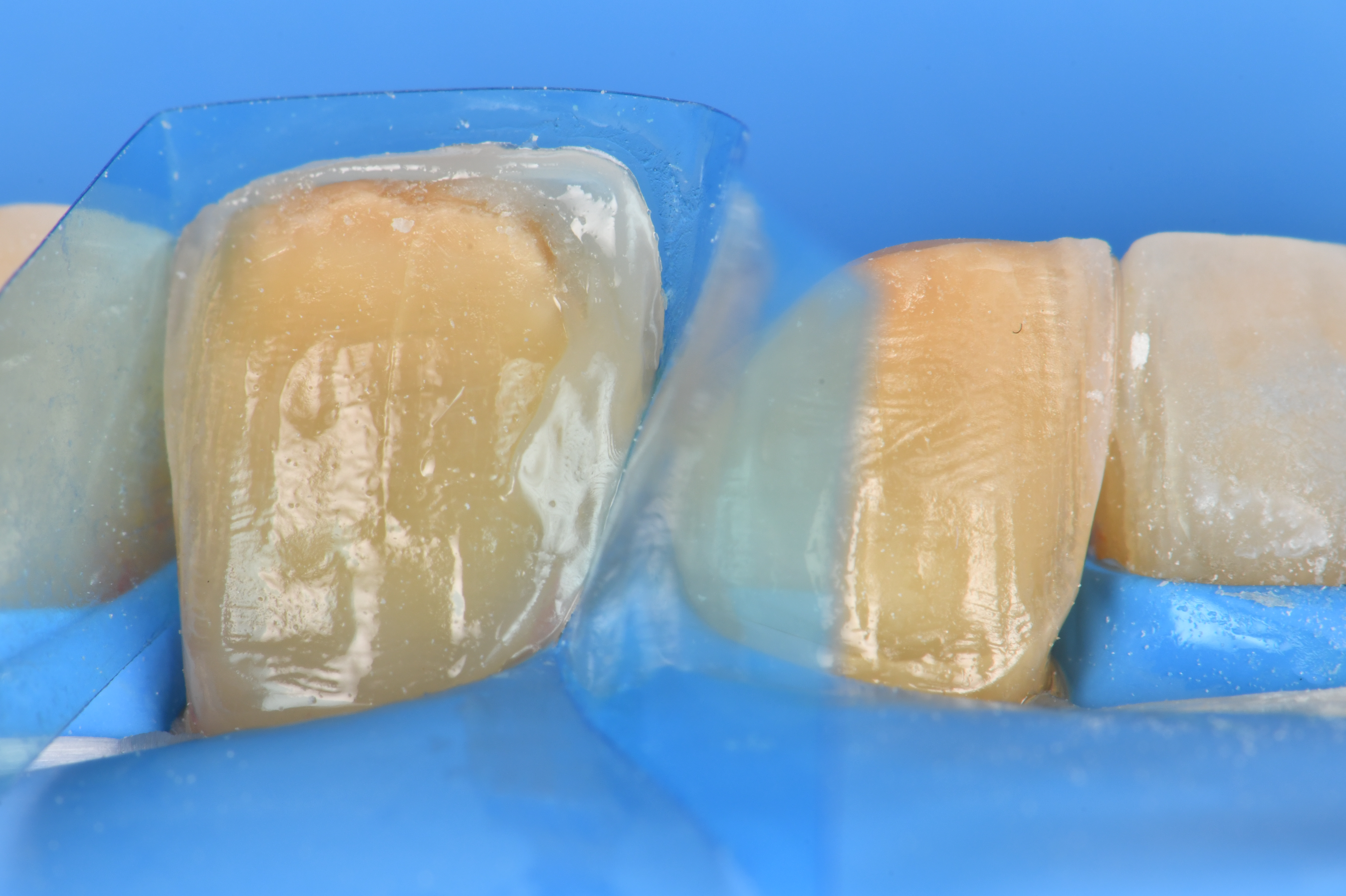 Case Study Image