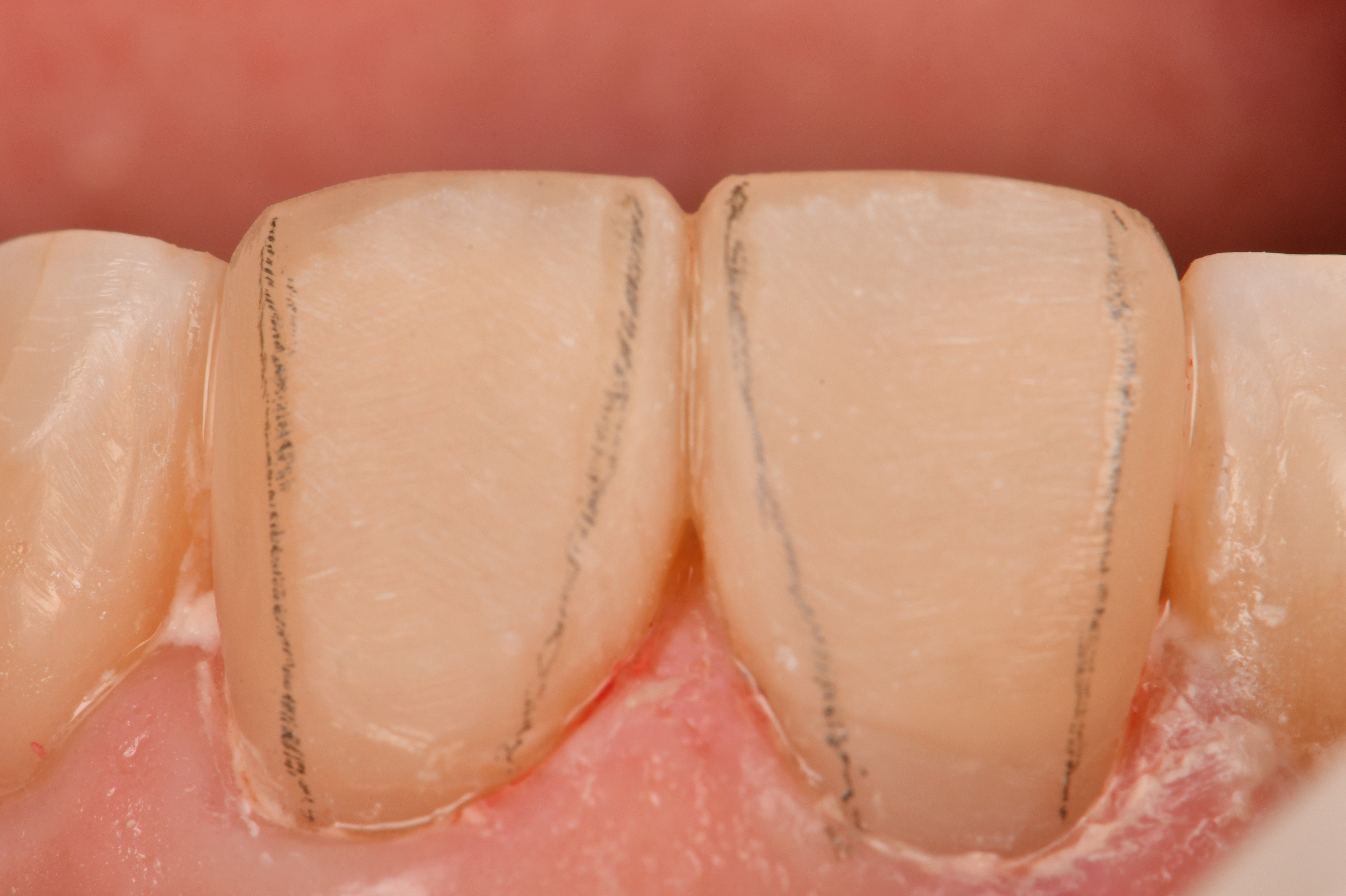 Case Study Image