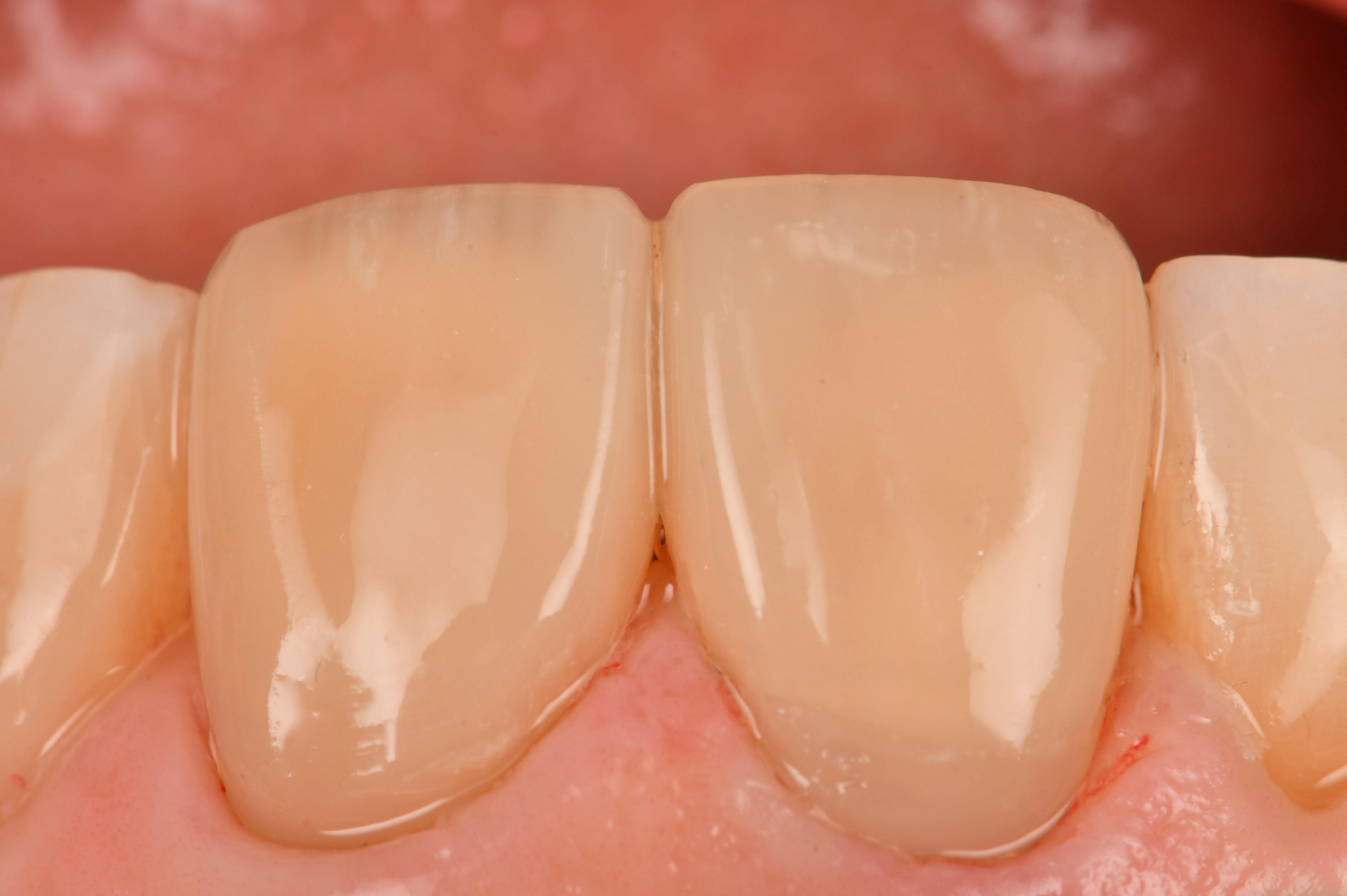 Case Study Image