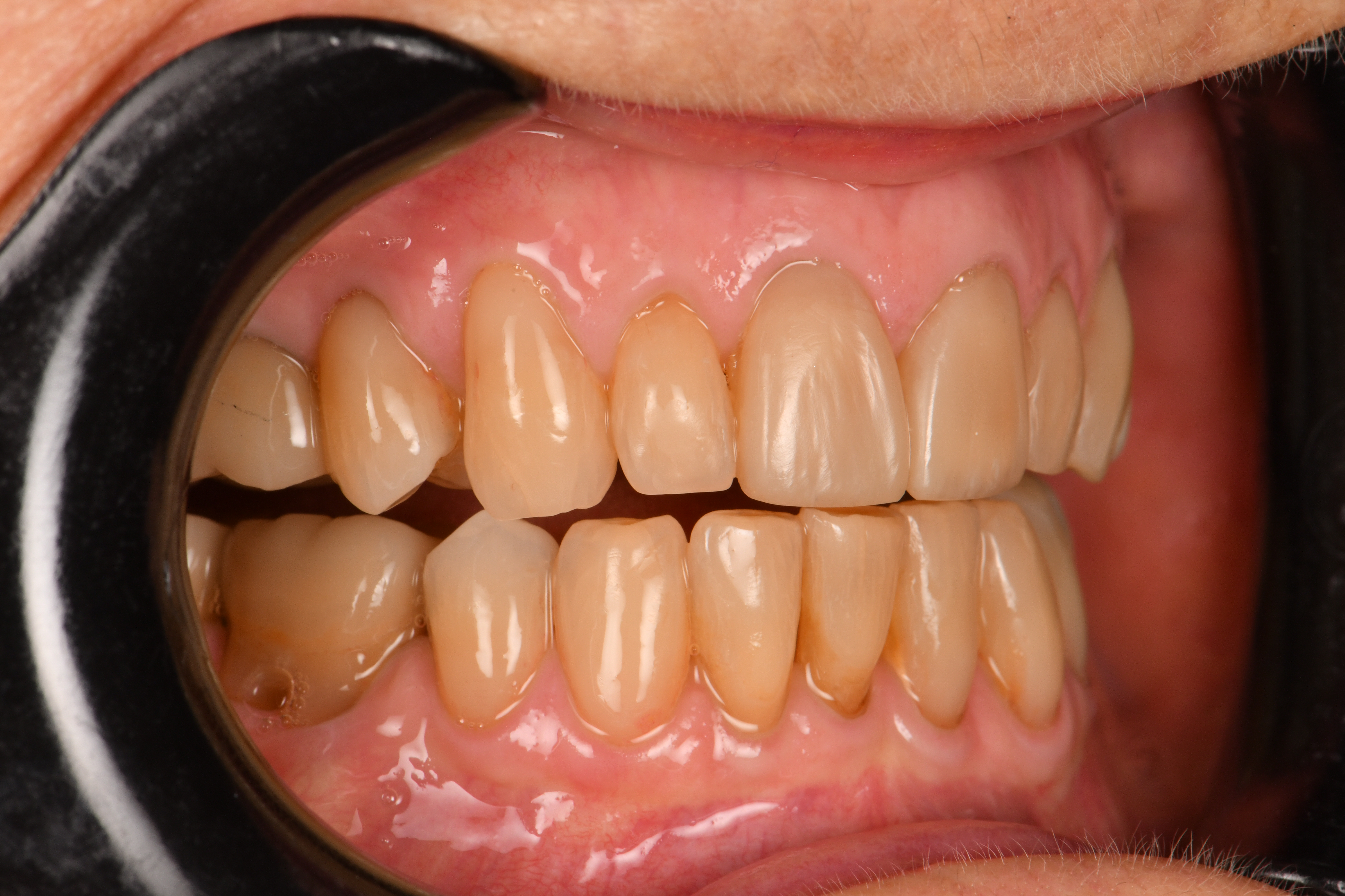 Case Study Image
