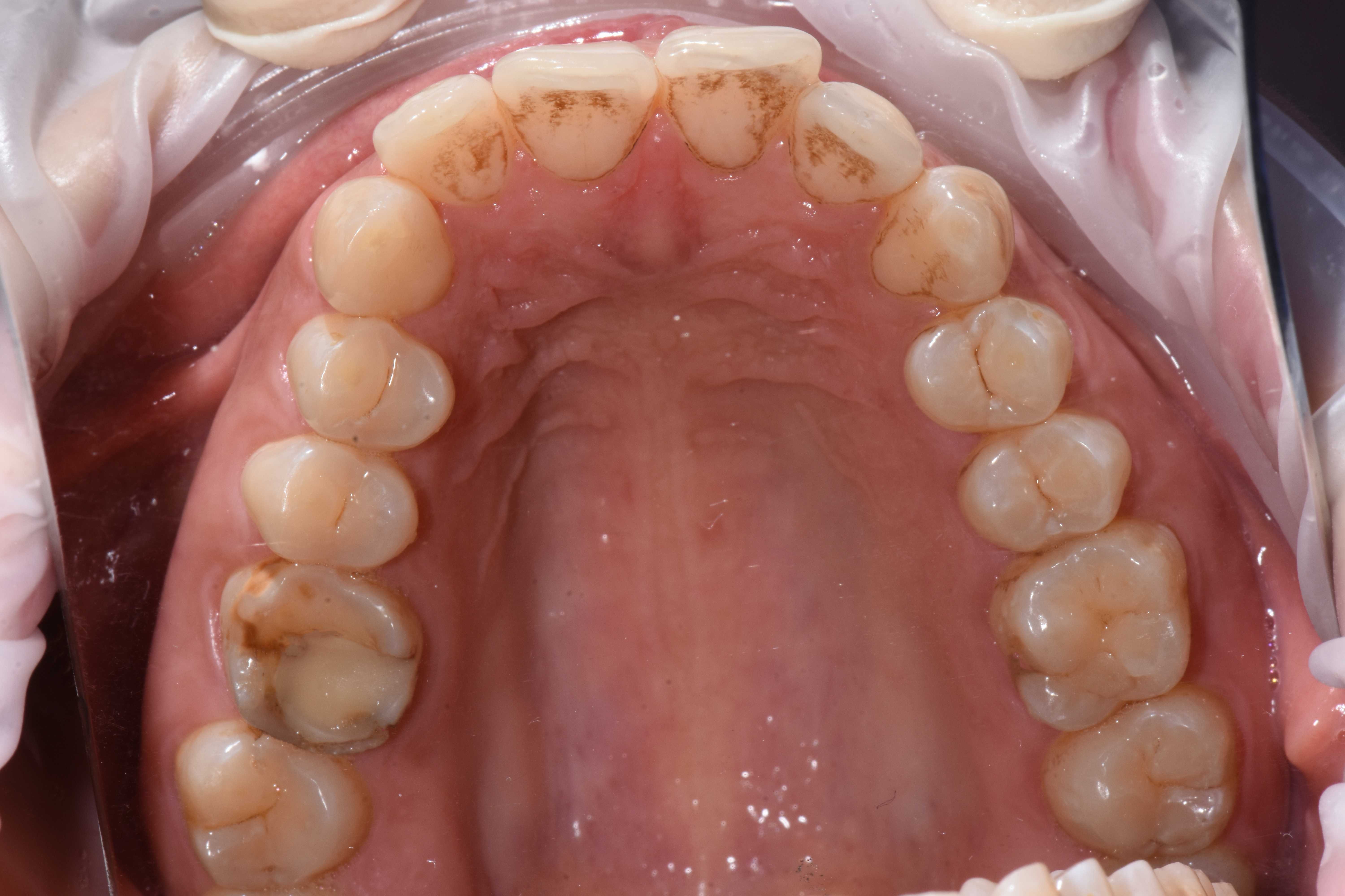 TommasoWeinstein_001_112221 Figure 1