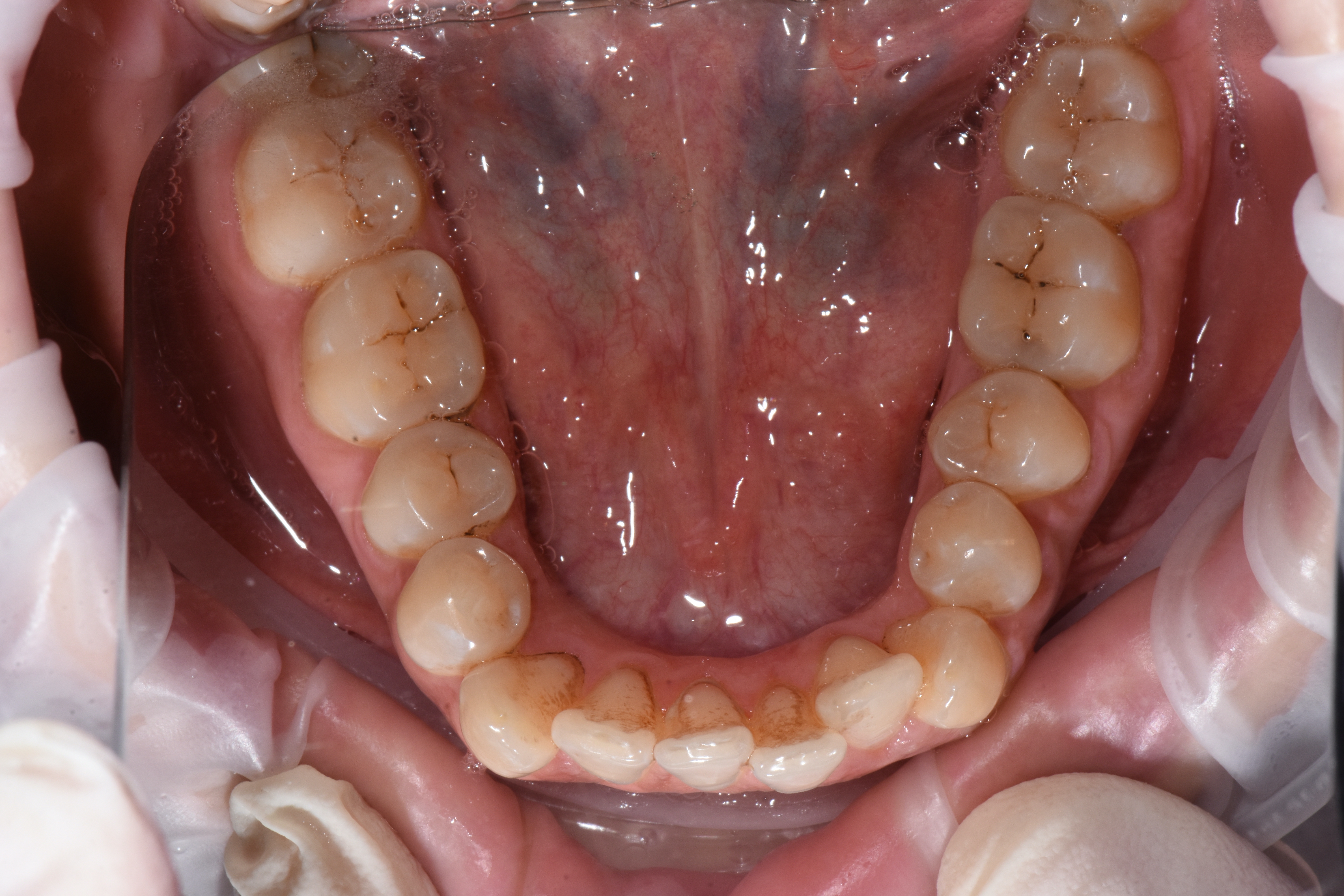 TommasoWeinstein_001_112221 Figure 2
