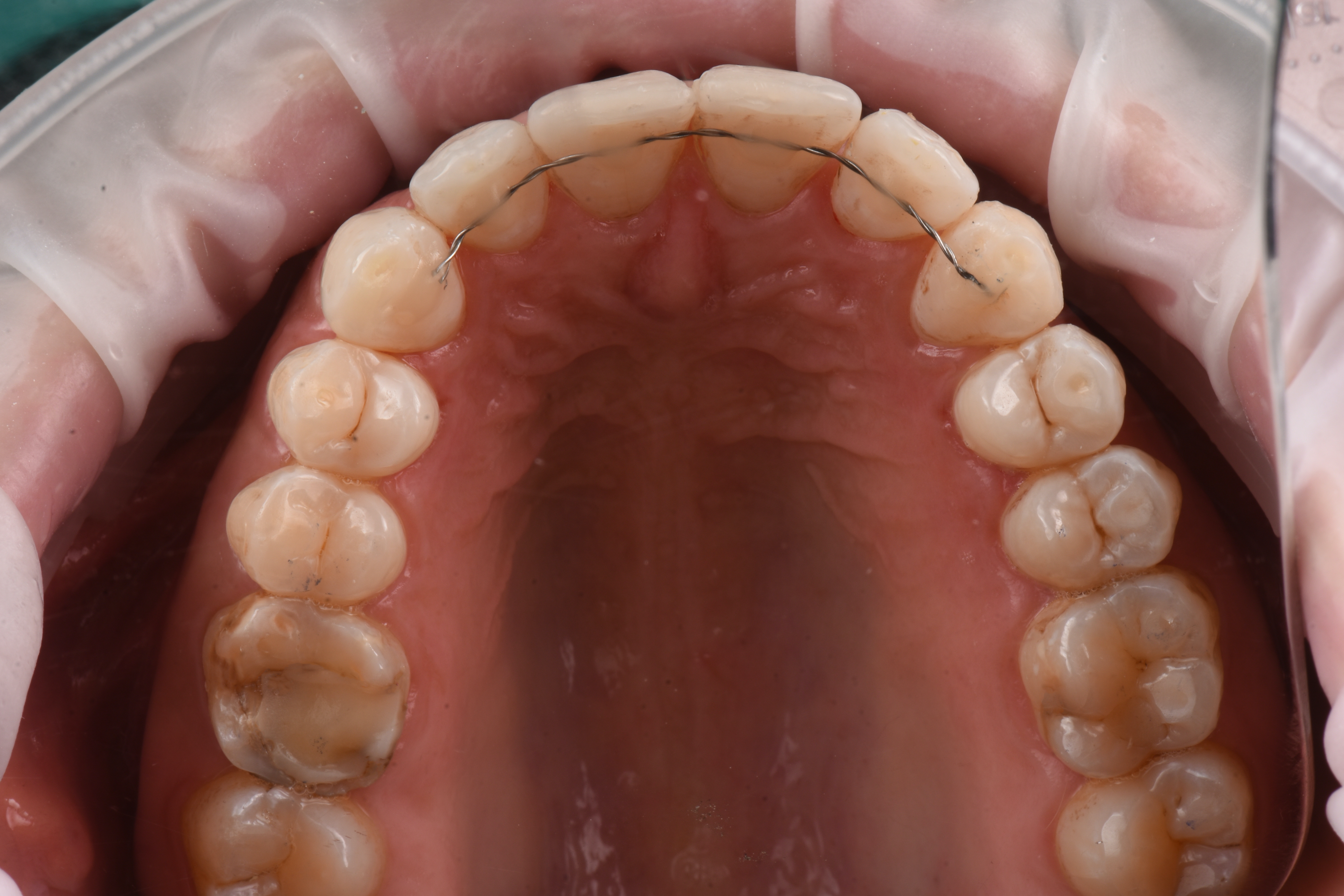 TommasoWeinstein_012_112221 Figure 12