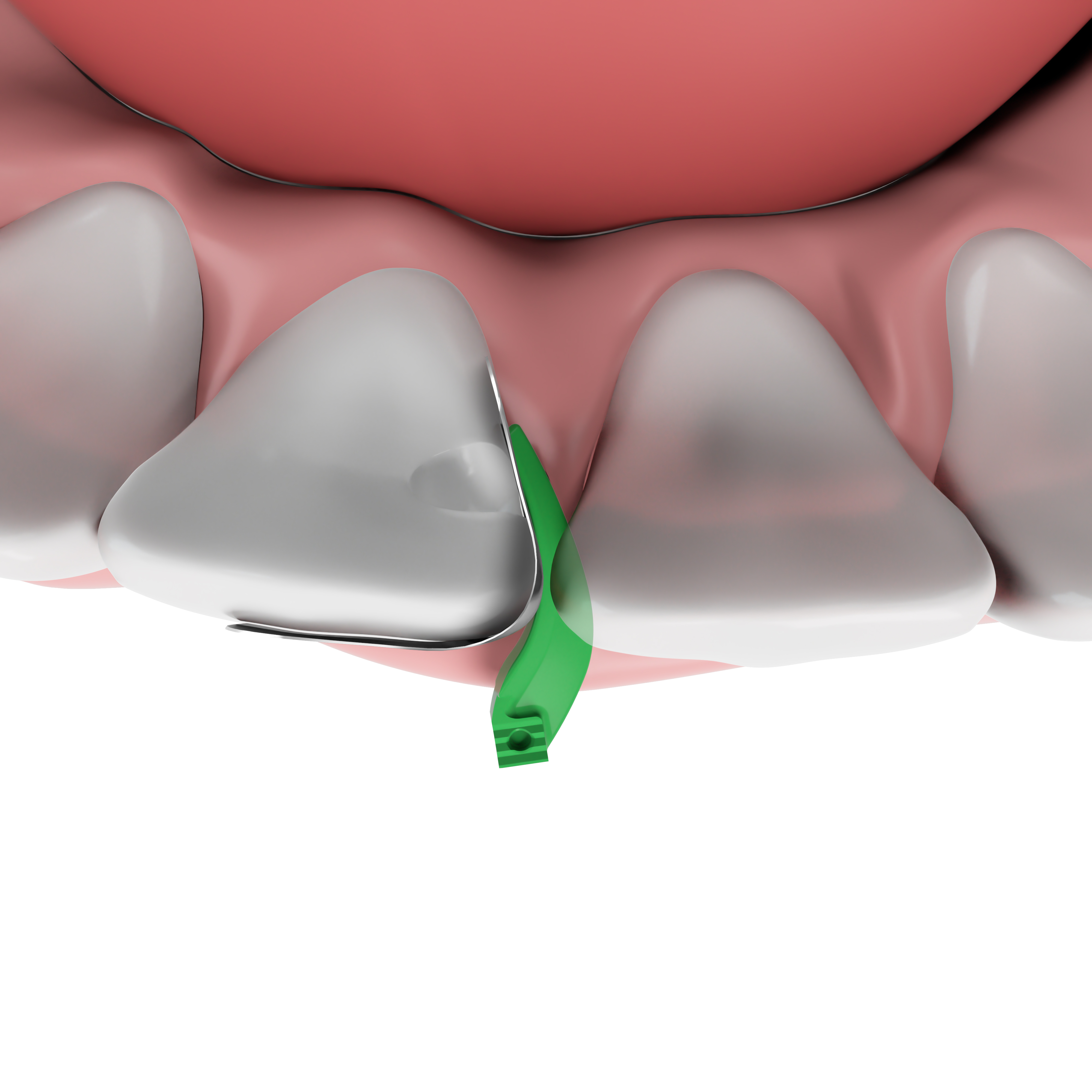 Anterior teeth model