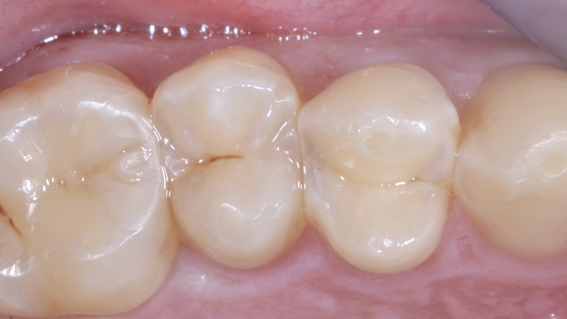 VincenzoAttanasio_001_06072023 Figure 1