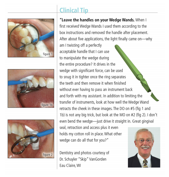 WedgeWands Clinical Tip