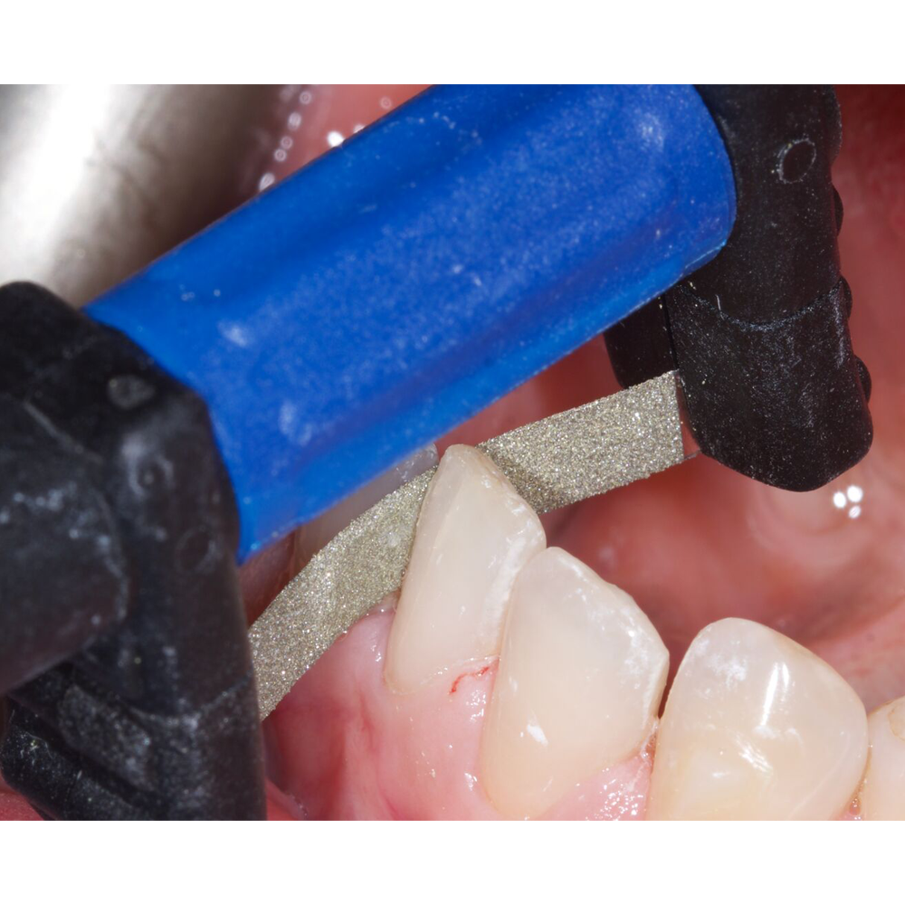 blue fitstrip