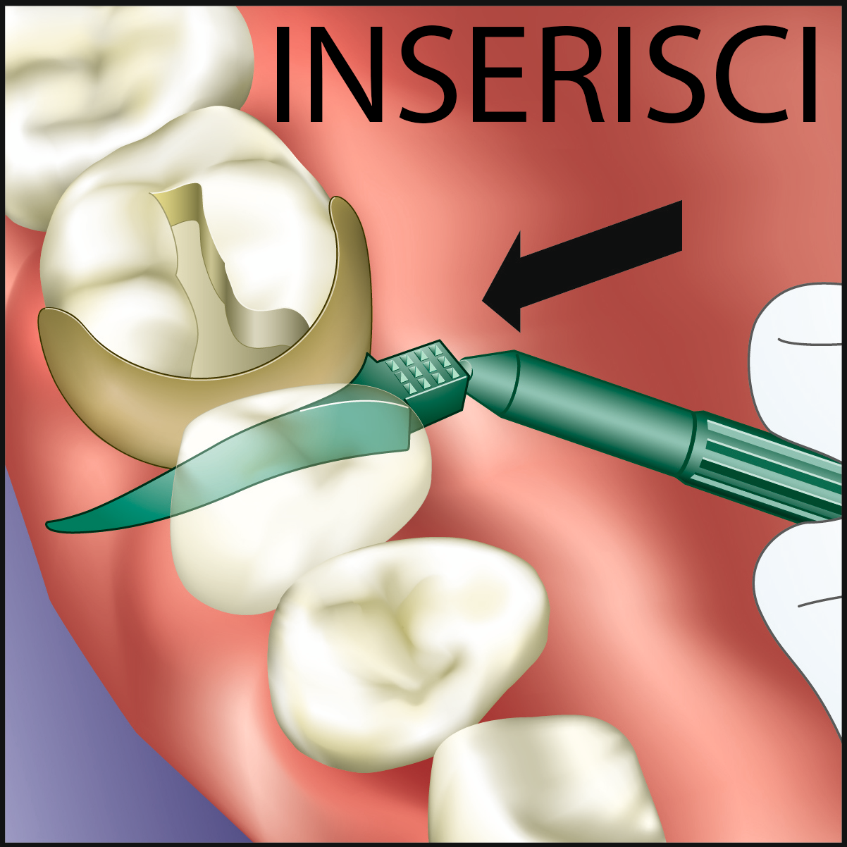 INSERISCI/INSERT