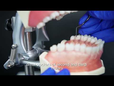 Mini Gracey 17/18 Curette | Distal Surfaces, Sharper Angulation