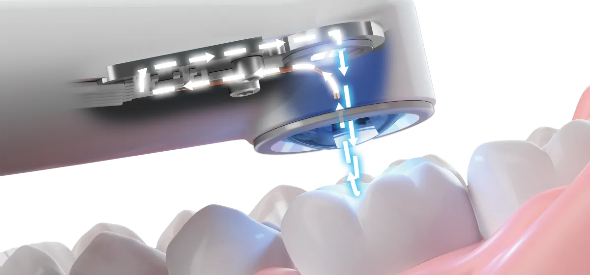 FeedbackLoop - Loop LED Curing Light