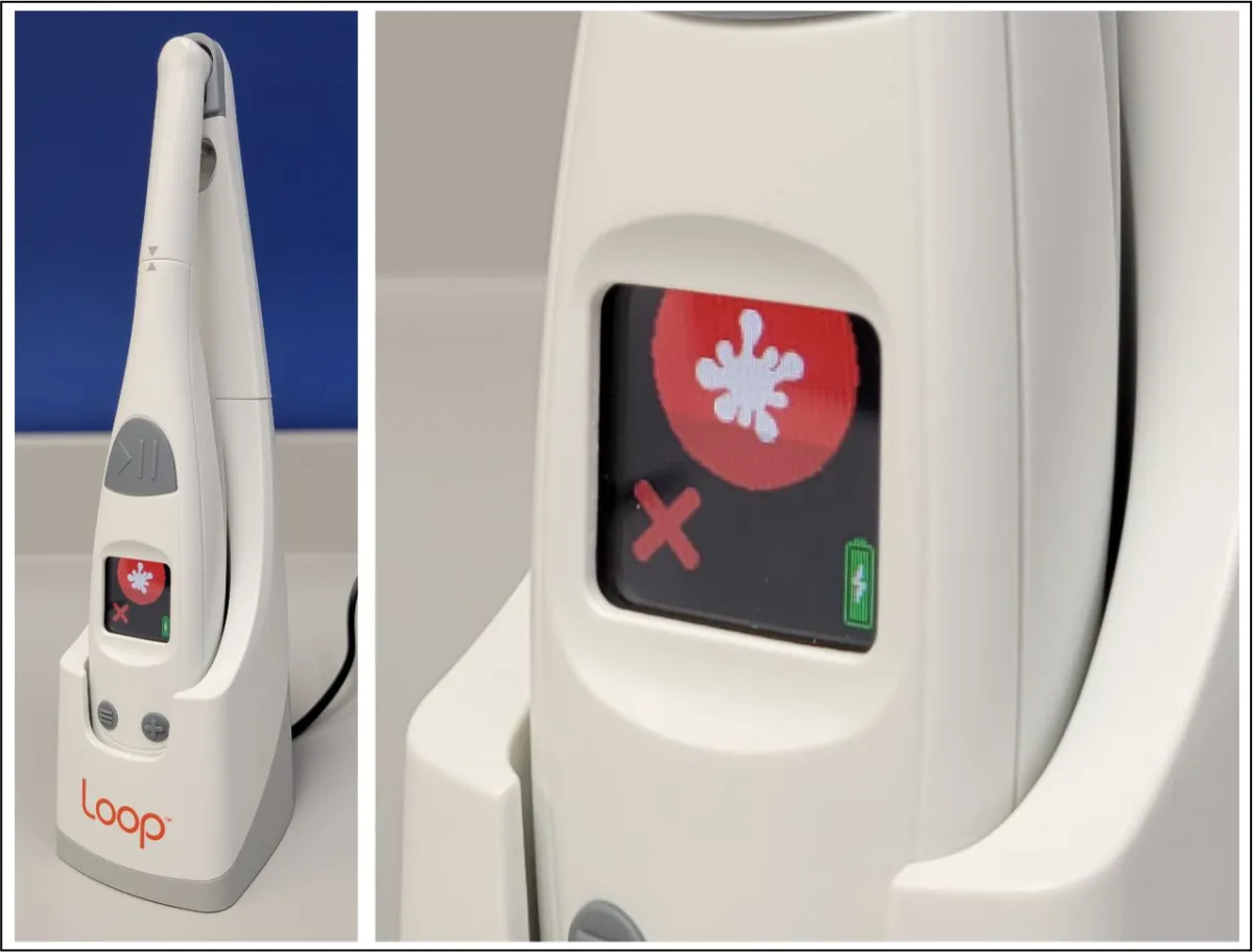 Figure 12 - Loop debris indicator.jpg