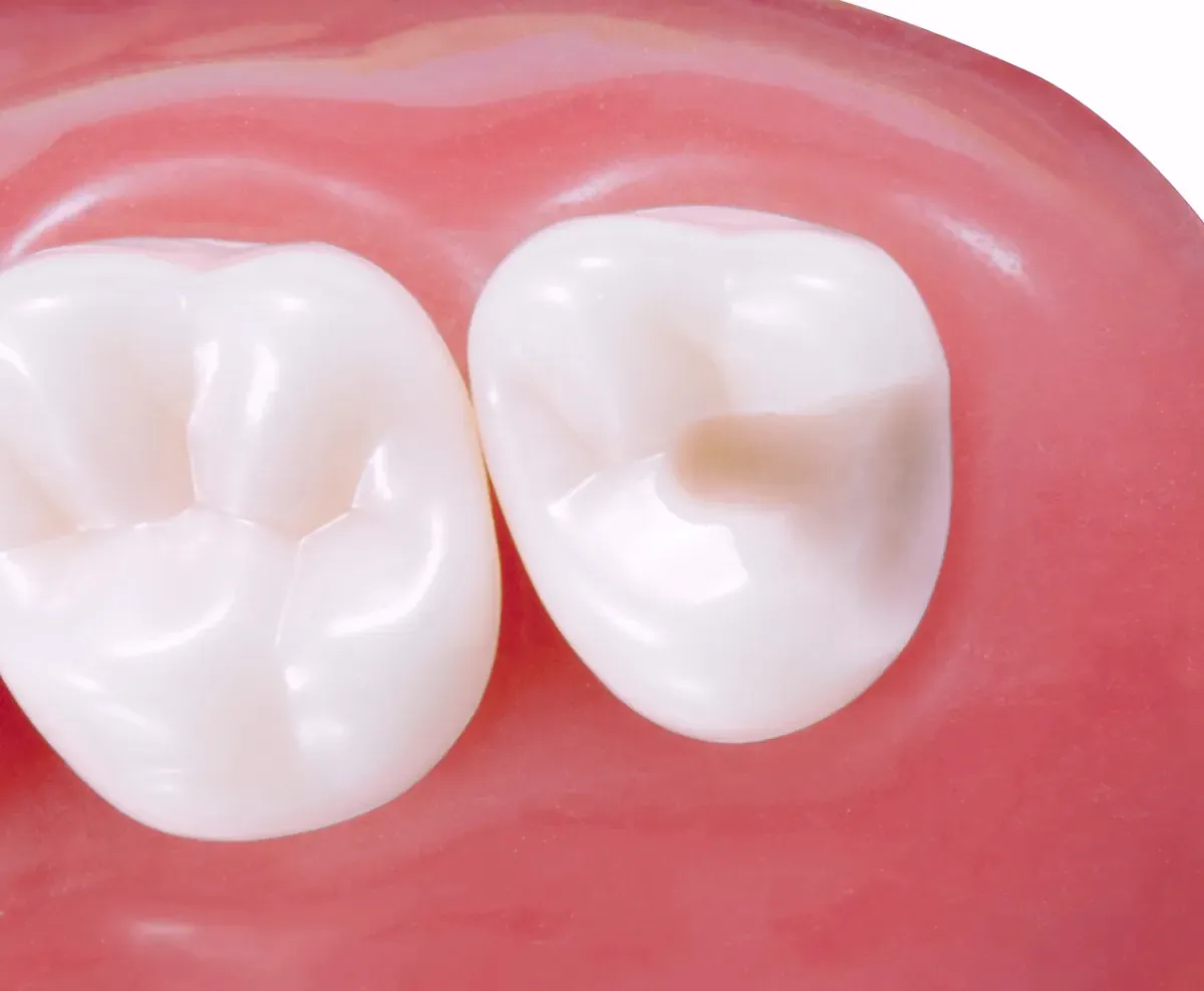 Last Tooth