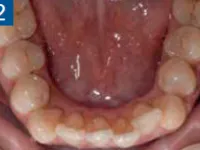 Teeth pre-op