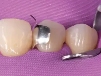 Strata-G Matrix Set in gap