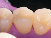 Strata-G final product after polish