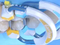Strata-G™ yellow and blue separator rings