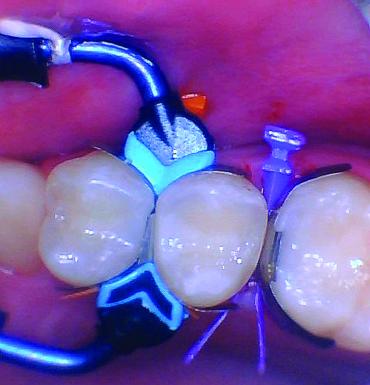 BurtonMatt_11_012025 Figure 11