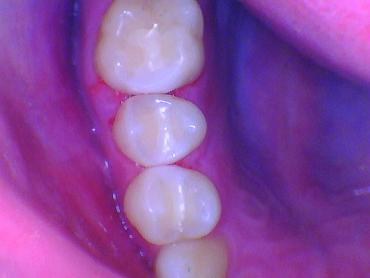 BurtonMatt_12a_012025 Figure 12a