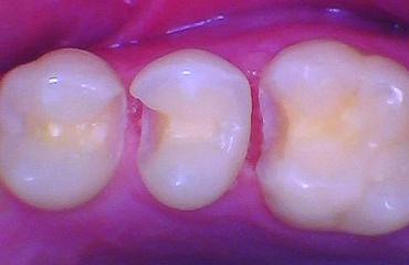 BurtonMatt_4a_012025 Figure 4a