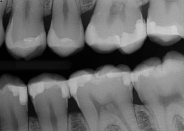BurtonMatt_pot op xray_012025 Figure 12b