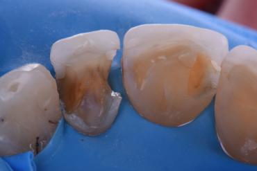 ClarenceTam_002_07132 Figure 2