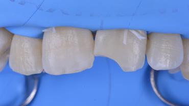 GianlucaRossi_002_040722 Figure 2