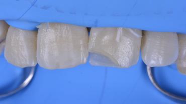 GianlucaRossi_003_040722 Figure 3