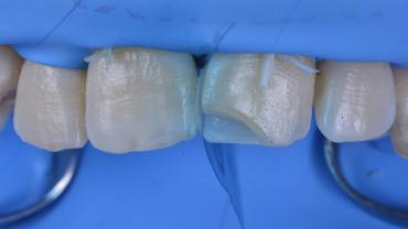 GianlucaRossi_004_04072 Figure 4