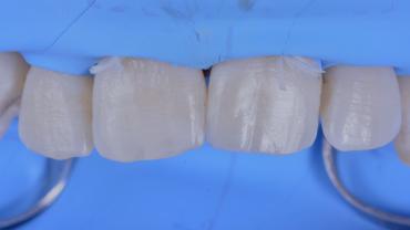 GianlucaRossi_006_040722 Figure 6