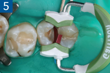 Figure 5